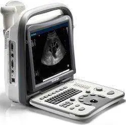 SonoScape A6 Ultrasound #