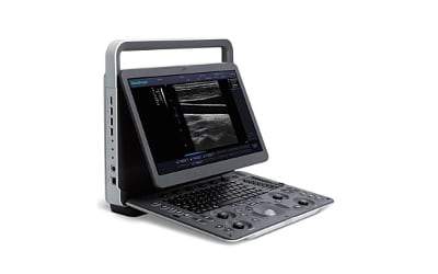 SonoScape A6V Expert - E1V Ultrasound #