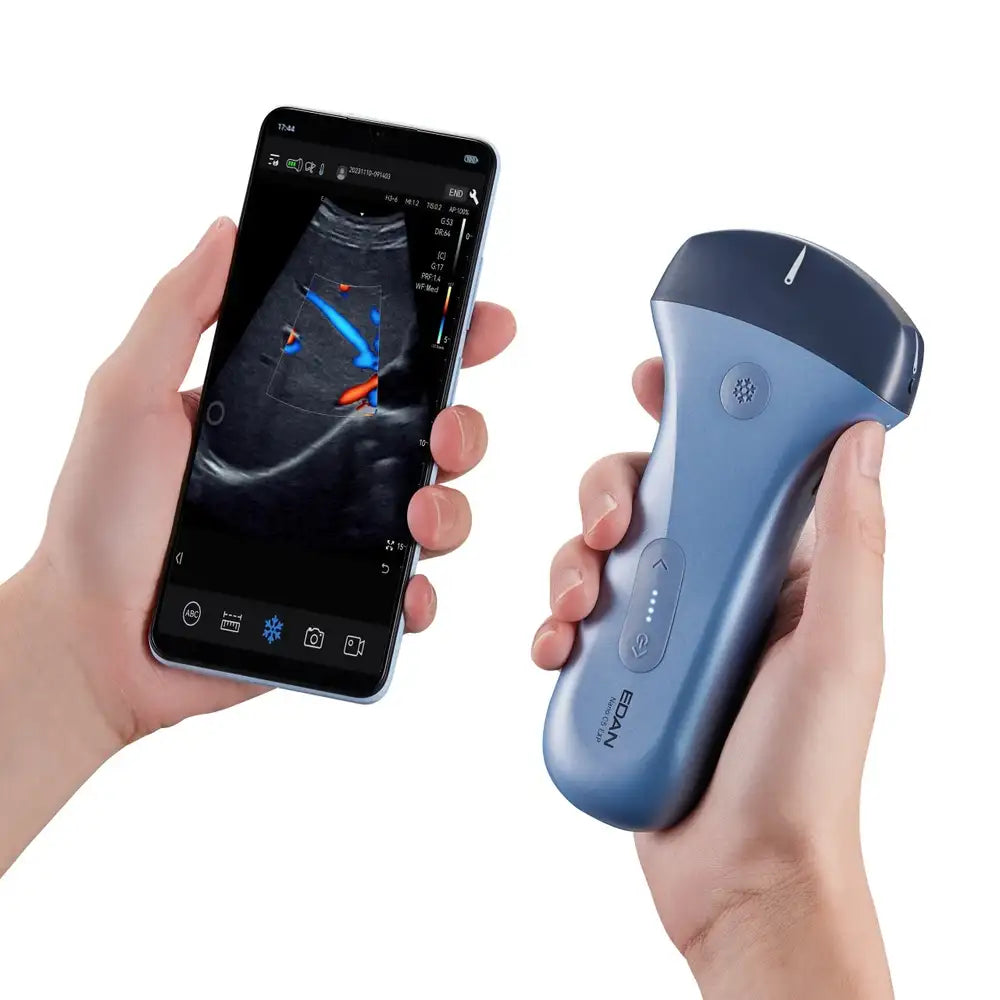 Portable Ultrasound System Edan Nano C5 Handheld – Wireless Handheld Ultrasound Scanner for Point-of-Care Diagnostic Imaging and Mobile Healthcare