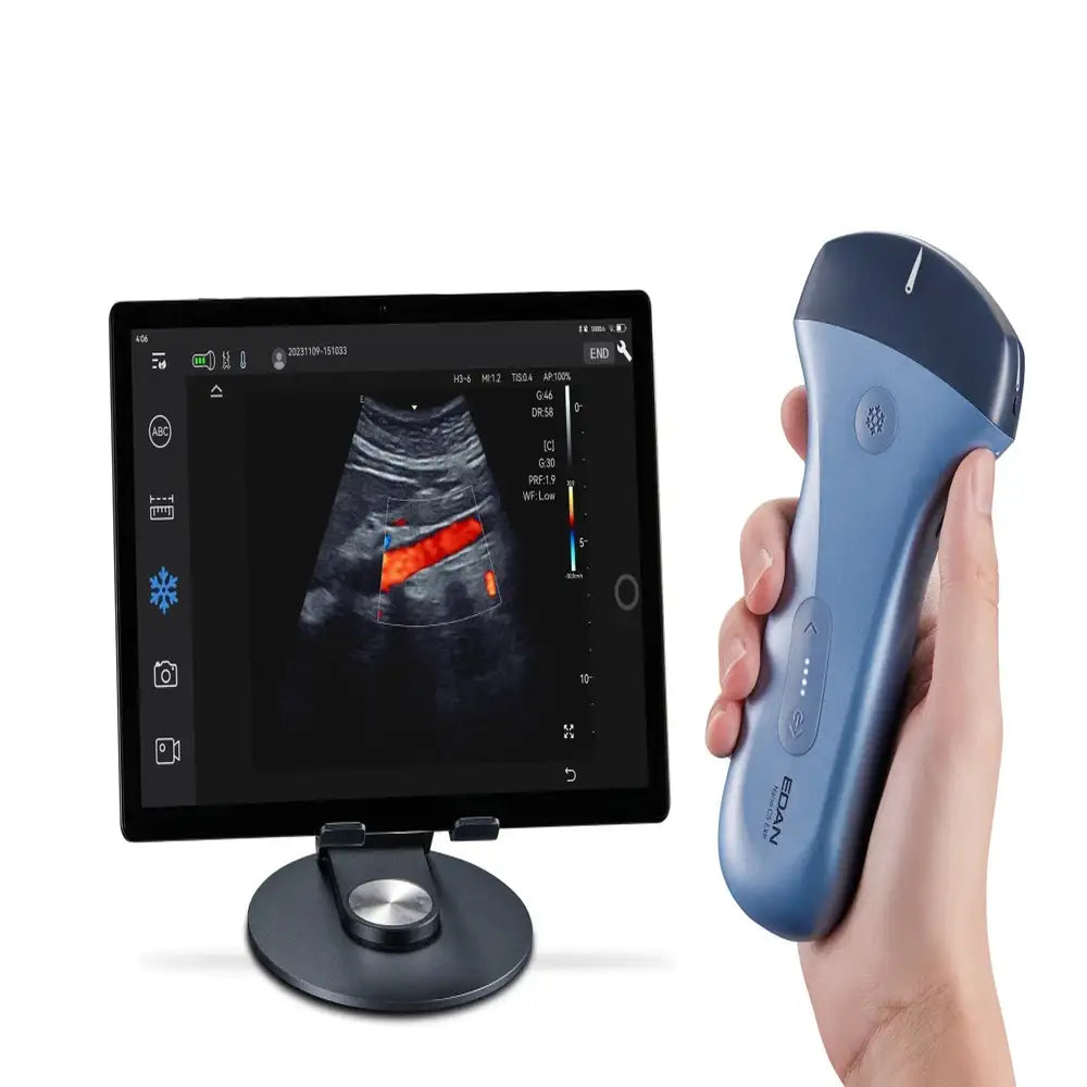 Portable Ultrasound System Edan Nano C5 Handheld – Wireless Handheld Ultrasound Scanner for Point-of-Care Diagnostic Imaging and Mobile Healthcare