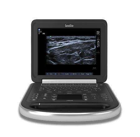 Sonosite Edge Ultrasound #