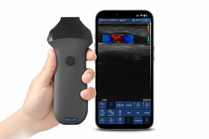 Global Healthcare Medical portable aesthetic  ultrasound scanner