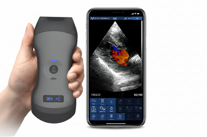 portable ultrasound scanner