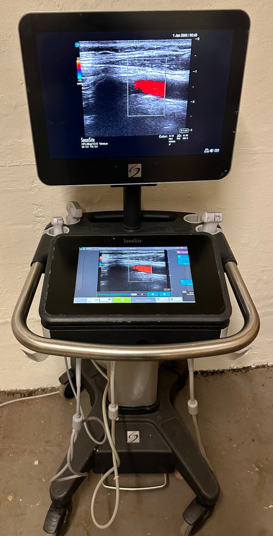 Sonosite X-Porte Ultrasound without probes manufactured 2021 #