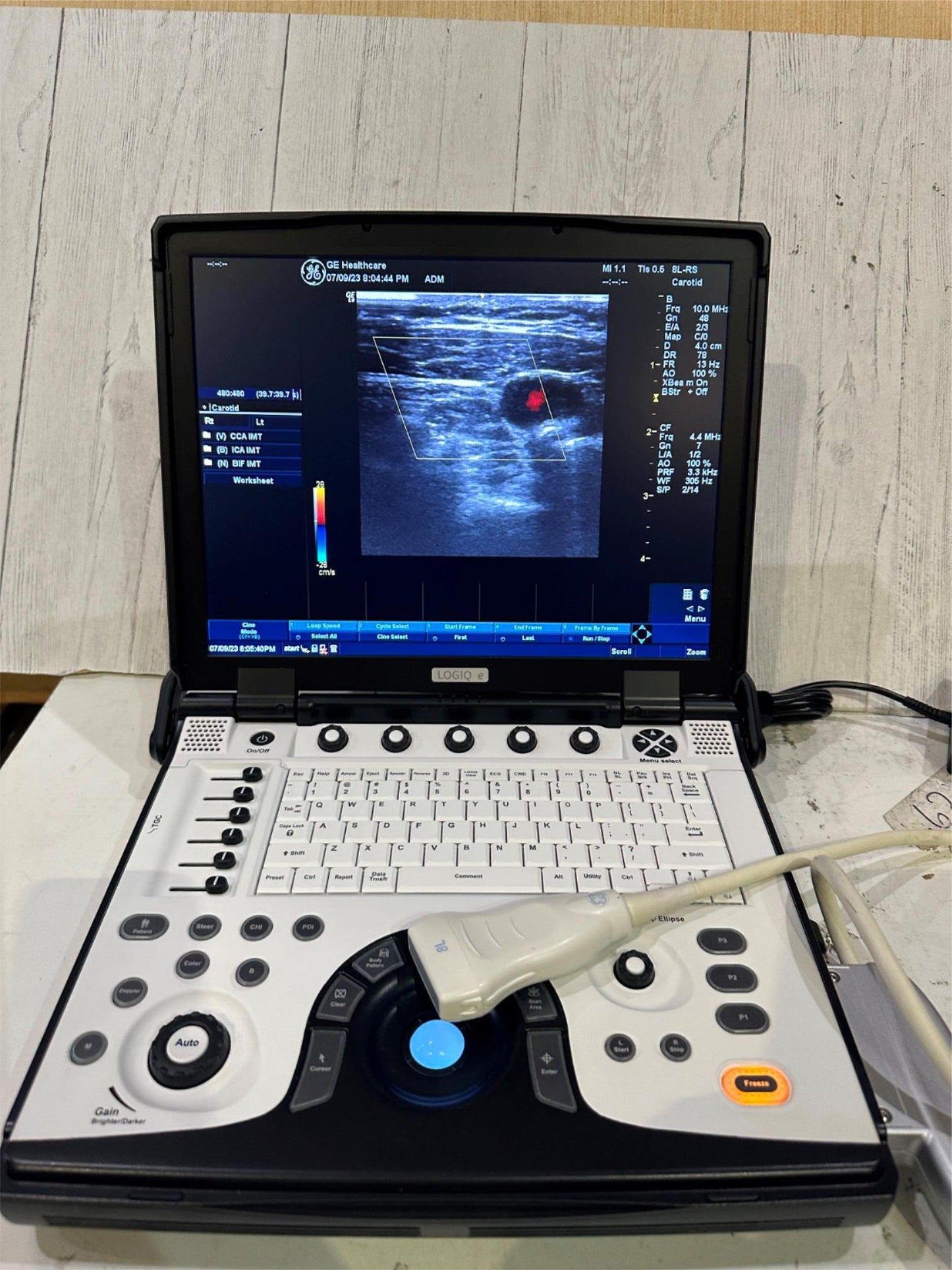 BT12 GE LOGIQ E Next Ge Ultrasound DOM 2016 #