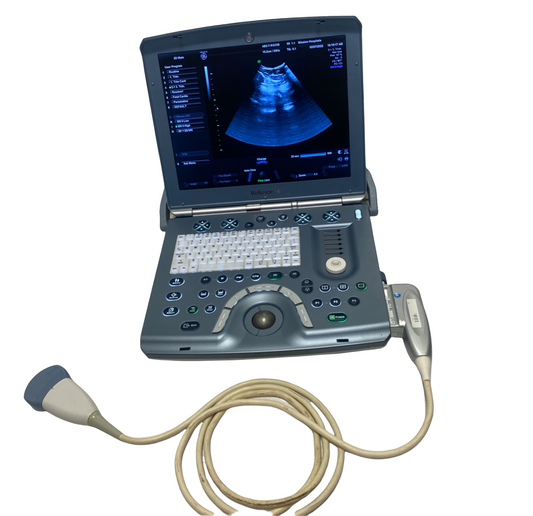 GE VOLUSON E PORTABLE ULTRASOUND MACHINE WITH 1 PROBE (AB2-7-RS) #