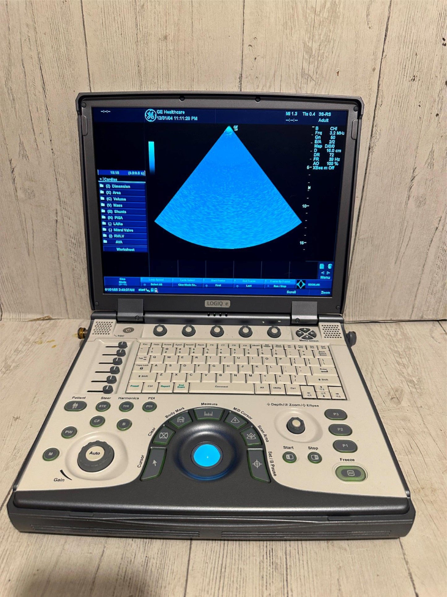 GE LOGIQ E Ultrasound 2006, Vascular, OBGYN, MSK #