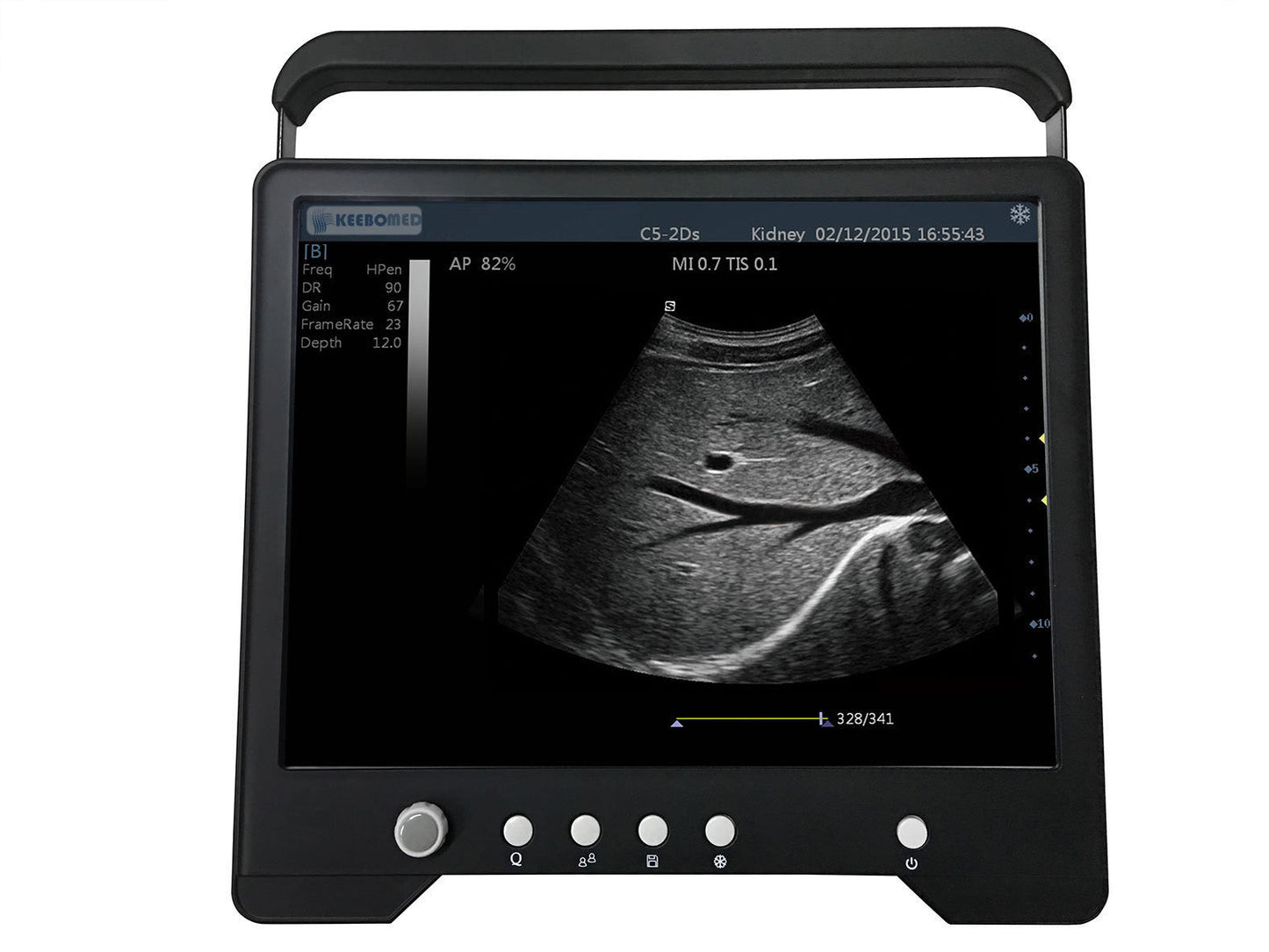 iSonoTouch 20V B&W Vet Ultrasound #