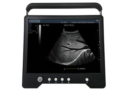 iSonoTouch 20V B&W Vet Ultrasound #