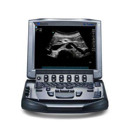Sonosite M Turbo Ultrasound #