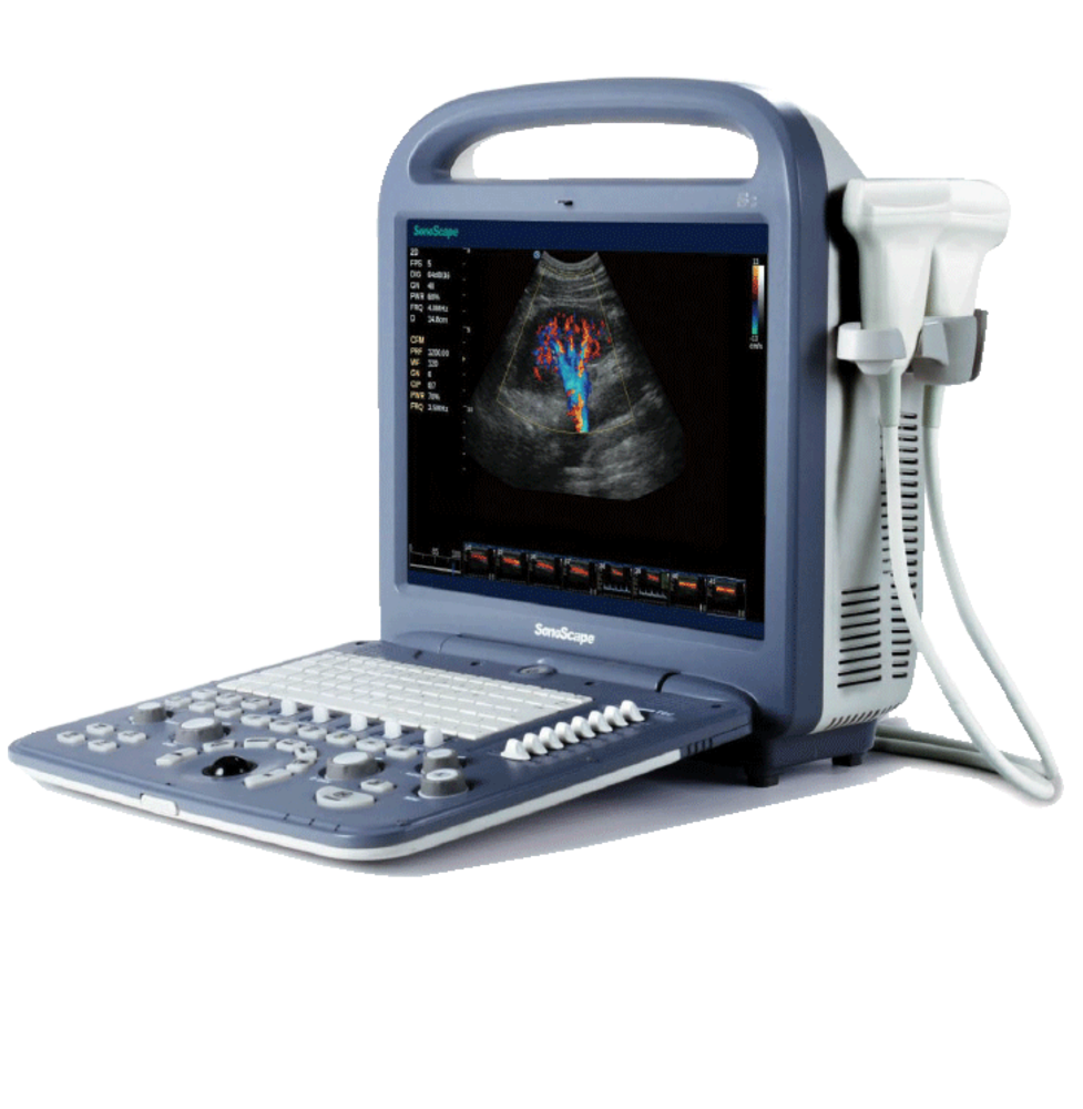 SonoScape S2V Vet Ultrasound #