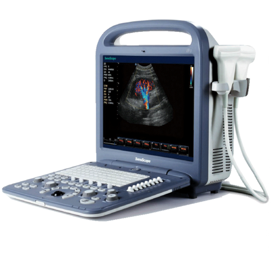SonoScape S2V Vet Ultrasound #
