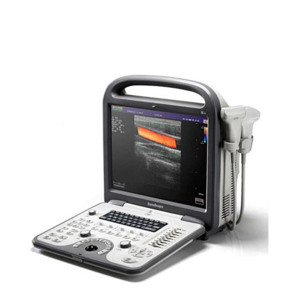 SonoScape S6V Vet Ultrasound #