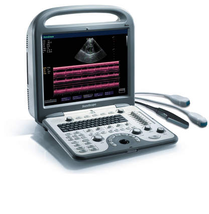 SonoScape S8V Vet Ultrasound #
