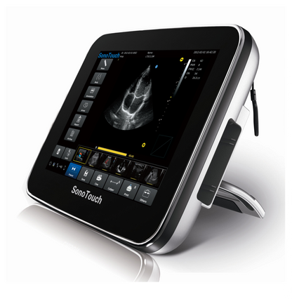 Chison SonoTouch 10 Vet Ultrasound #