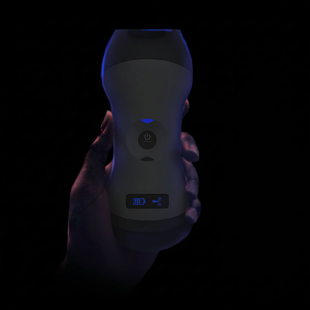 Global Healthcare Medical Wireless Handheld 3-in-1 Ultrasound System