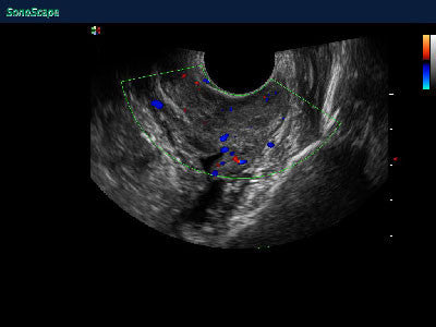 SonoScape S8V Vet Ultrasound #