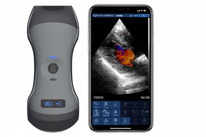 wireless ultrasound scanner