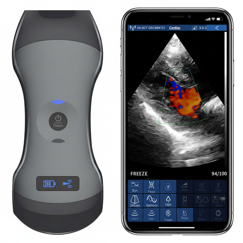 Global Healthcare Medical wireless ultrasound scanner 
