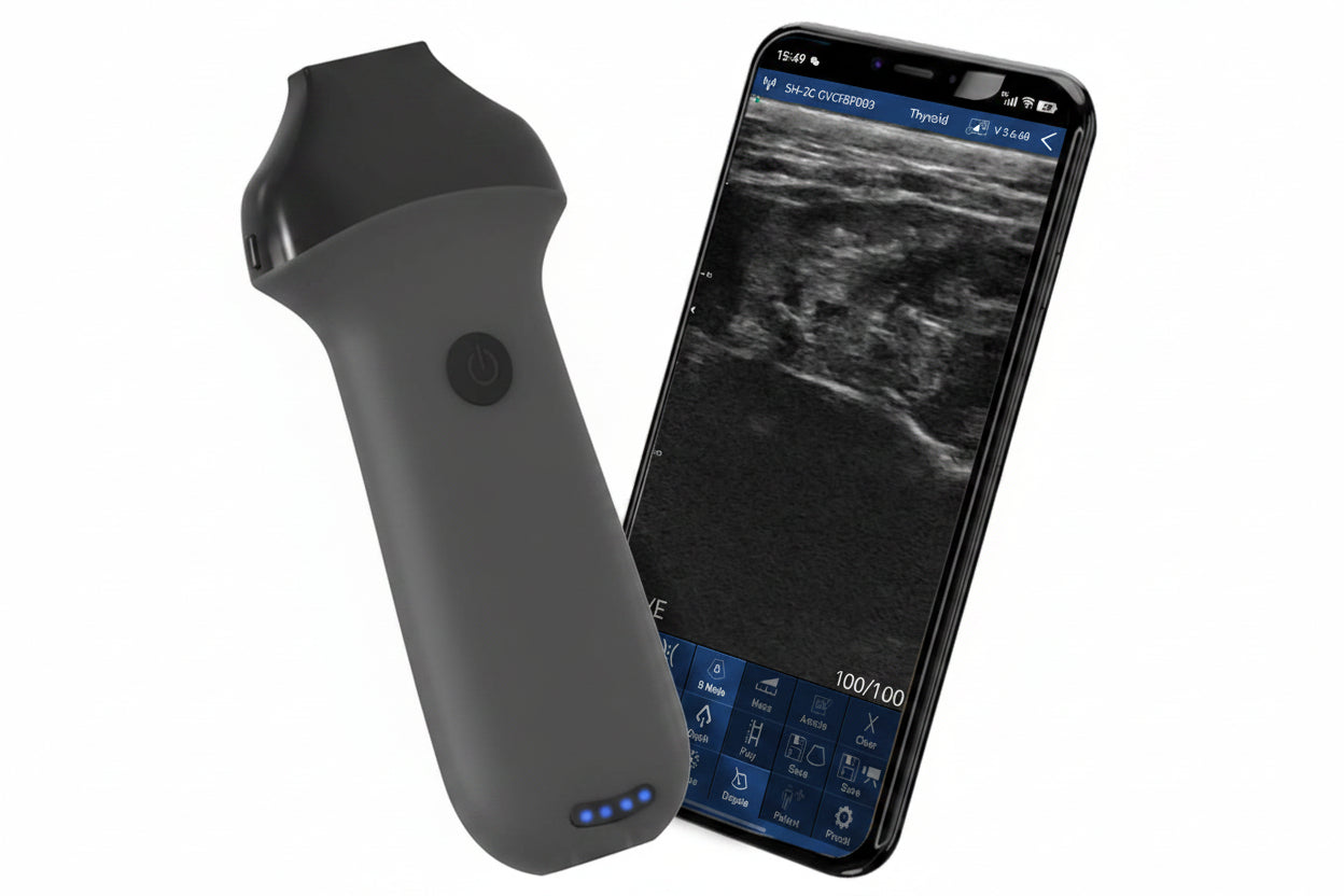 Global Healthcare Medical Linear Portable Ultrasound Machine