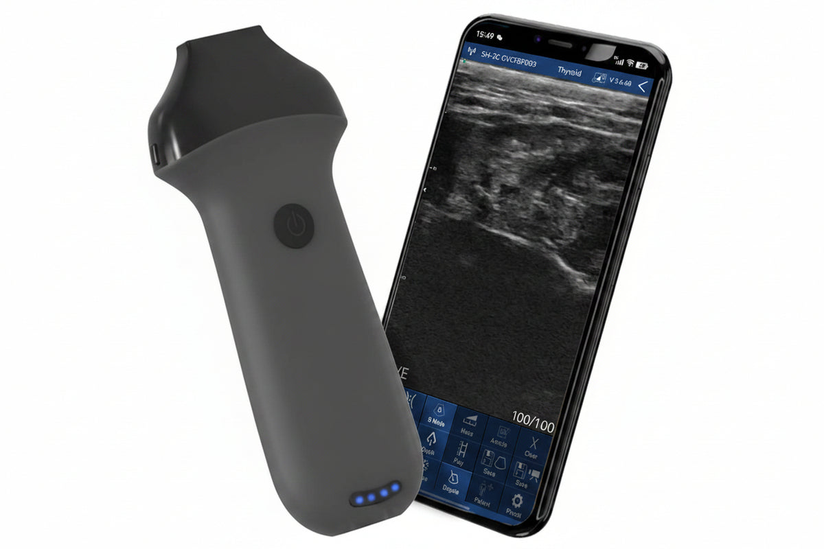 Global Healthcare Medical Linear Portable Ultrasound Machine