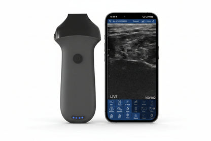Global Healthcare Medical 8P Linear Wireless Probe Type Ultrasound Scanner