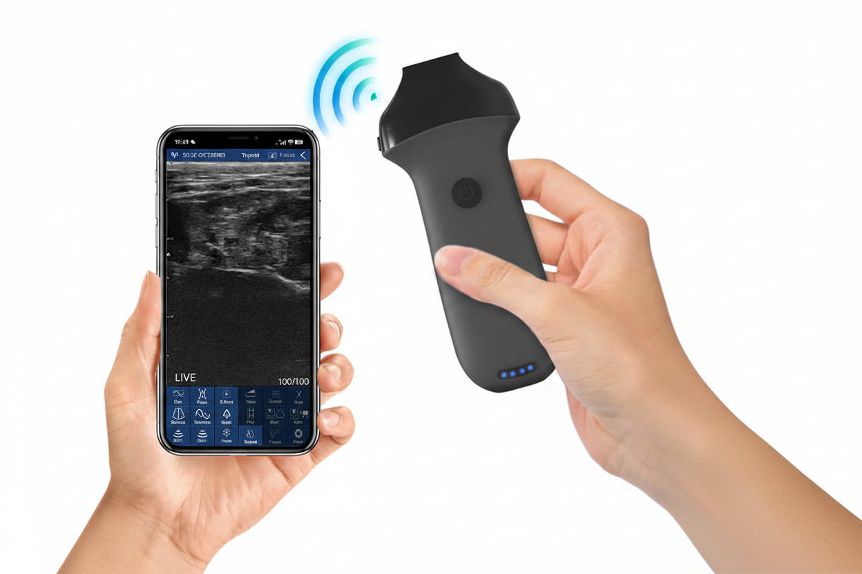 Global Healthcare Medical Wireless Aesthetic Ultrasound Scanner